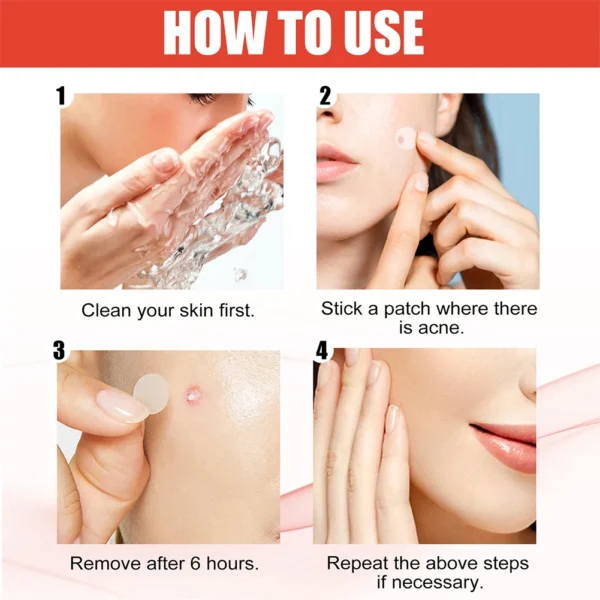 144pcs Acne Patch Set - Invisible Spot Stickers for All Skin Types - Image 5