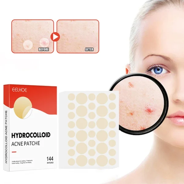 144pcs Acne Patch Set - Invisible Spot Stickers for All Skin Types