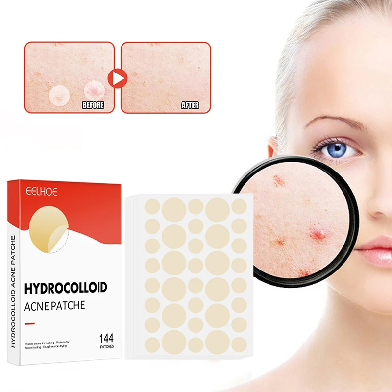 144pcs Acne Patch Set - Invisible Spot Stickers for All Skin Types