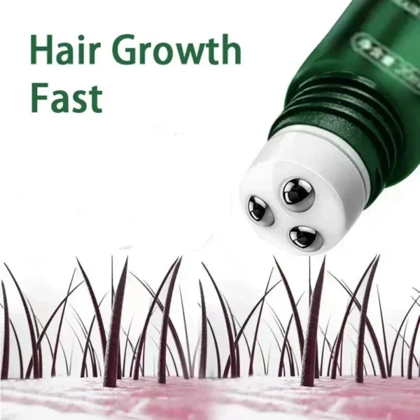 Fast-Acting Hair Growth Oil – Anti-Baldness, Postpartum & Hereditary Hair Loss Repair Solution - Image 2