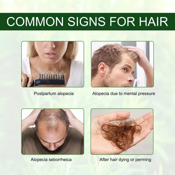 Fast-Acting Hair Growth Oil – Anti-Baldness, Postpartum & Hereditary Hair Loss Repair Solution - Image 6